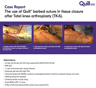 Case Report The use of Quill® Barbed Suture in Tissue Closure After Total Knee Arthroplasty (TKA)