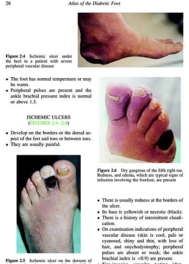 Atlas of Diabetic Foot
