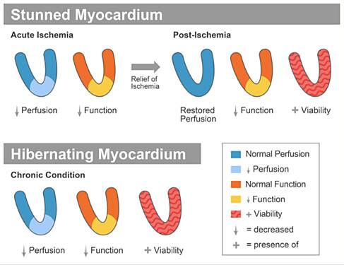 Myocardial Viability