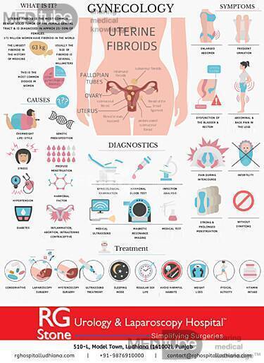 Gynecology – Uterine Fibroids Symptoms, Causes & Diagnostics • Document ...