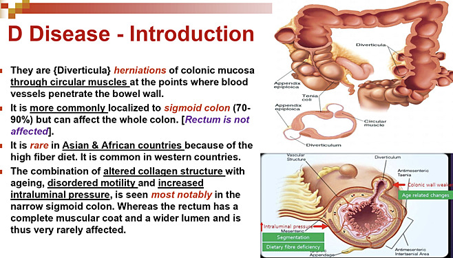 Diverticulosis, Volvulus & Rectal Prolapse