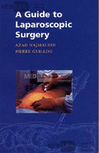 Guide to Laparoscopic Surgery