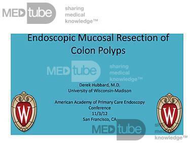 Endoscopic Mucosal Resection of Colon Polyps