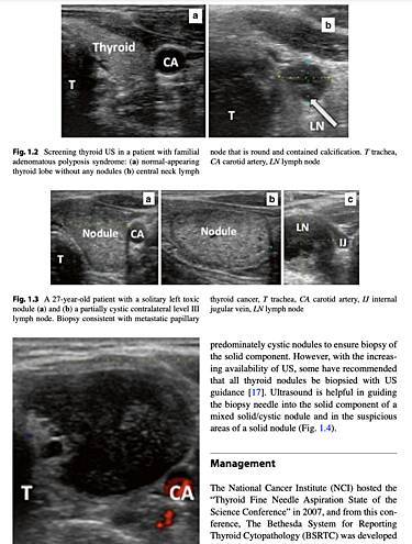Controversies in Thyroid Surgery