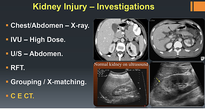 Urological Trauma & Infections