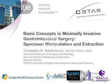 Basic Concepts in Minimally Invasive Gastrointestinal Surgery