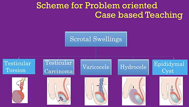 Scrotal Swellings