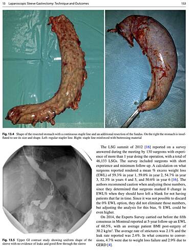 Bariatric Surgery 2020