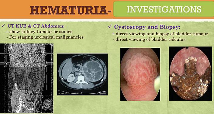 Urology / Hematuria / Renal & Ureteric Colic / Bladder Outlet Obstruction