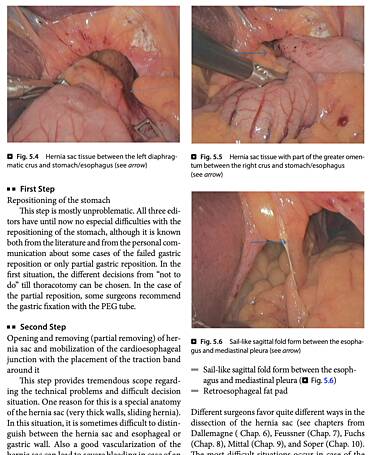 Gastrointestinal Operations and Technical Variations