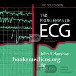 150 Problems of ECG