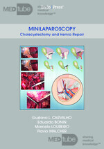 Minilaparoscopy - Cholecystectomy and Hernia Repair