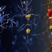 Advancing Alzheimer’s Research: Characterisation, Diagnosis & Treatment