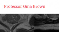 Pelvic MRI for the Colorectal Multidisciplinary Team