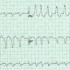 ECG Academy