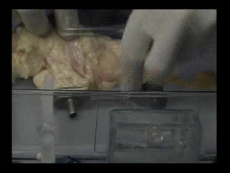Kidneys Placement In Pulsatile Perfusion - Machine Preparation