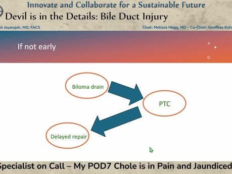 HPB Specialist on Call – My POD7 Chole is in Pain and Jaundiced, Help