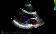 Echocardiography - Parasternal View - Normal Study