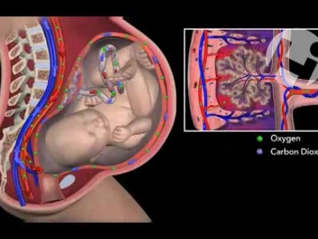Decreased Fetal Circulation Due to Placental Infarction