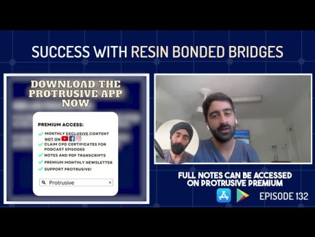 Success with Resin Bonded Bridges (aka Adhesive Bridges or formerly Maryland)