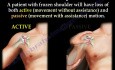 Adhesive Capsulitis & Frozen Shoulder - Video Lecture