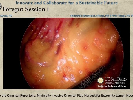 Adding to the Omental Repertoire - Minimally Invasive Omental Flap Harvest for Extremity Lymph Node Transfer