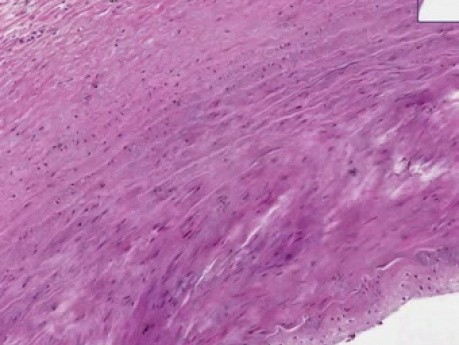 Large Artery - Histology
