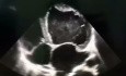 7. Echocardiography Case - What You See?