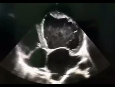 7. Echocardiography Case - What You See?