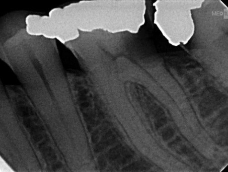 Jeni Motor Clinical Case