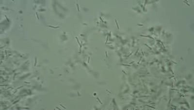 Vagina - Lactobacillus acidophilus