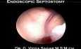 Endoscopic Septostomy