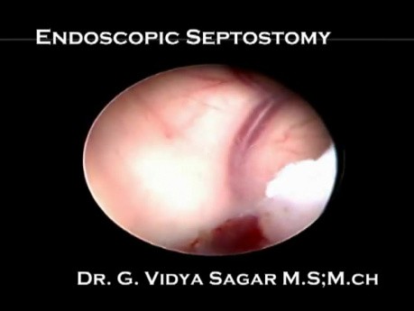 Endoscopic Septostomy