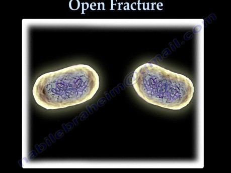 Unbelievable Bacteria - Video Presentation - Part 1