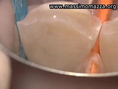 Value Of Microscopy In Prosthetic Dentistry