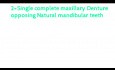 Single complete Denture in prosthodontics||Single complete Denture in English||Single complete Denture Defination||Single complete Denture indications, advantag