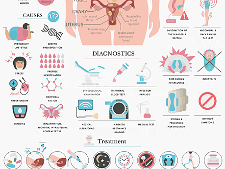 Gynecology – Uterine Fibroids Symptoms, Causes & Diagnostics