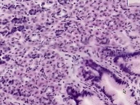 Gastric Fundus - Histology