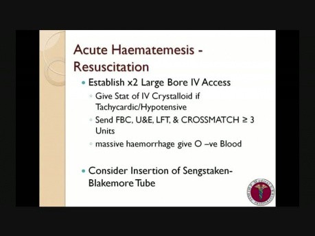 Surgical Emergencies - Mini Series Lecture 1 – Acute Haematemesis