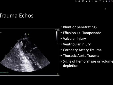 Interesting Echo Cases from St. Michael's Hospital