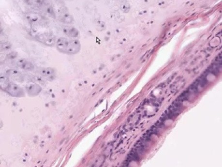 Trachea - Histology
