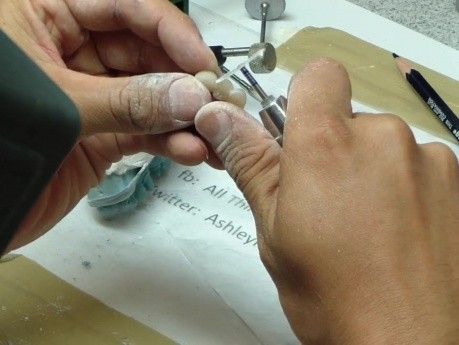Temporary Bridge - Diamond Disks And Interproximal Areas