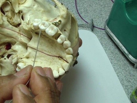 Greater Palatine Anatomy Part 1