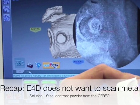 E4D Scanning Implant Abutment
