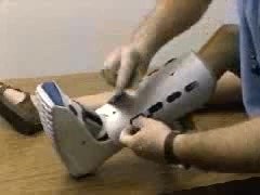 Lower Limb Immobilization
