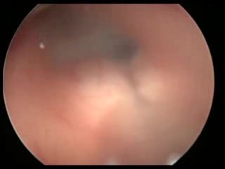 Neuronavegador