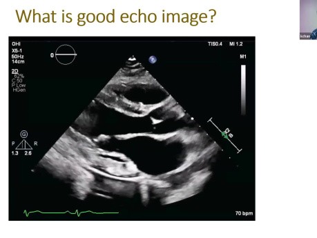 What is a Good Echo