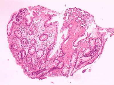 Rectum (17 of 30)