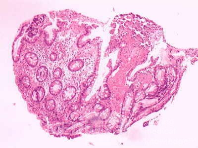 Rectum (17 of 30)