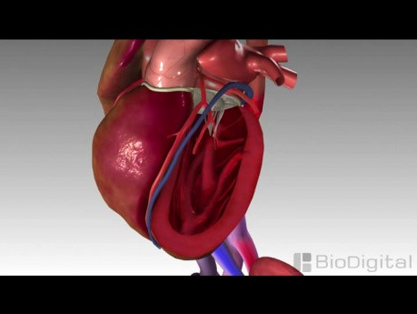 Congestive Heart Failure